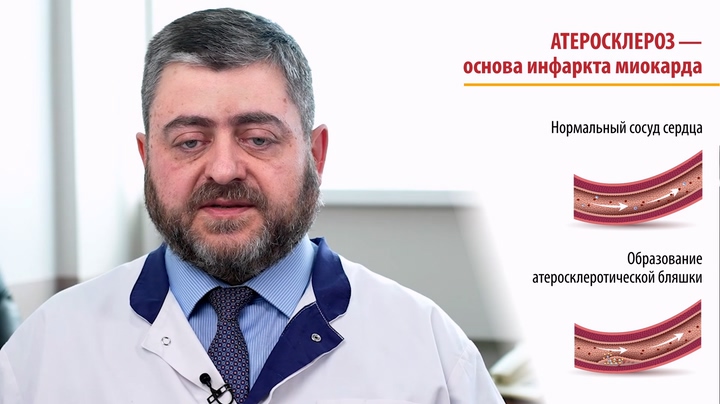 3. Что Приводит К Развитию Инфаркта Миокарда .Mp4 20251125 174906.455