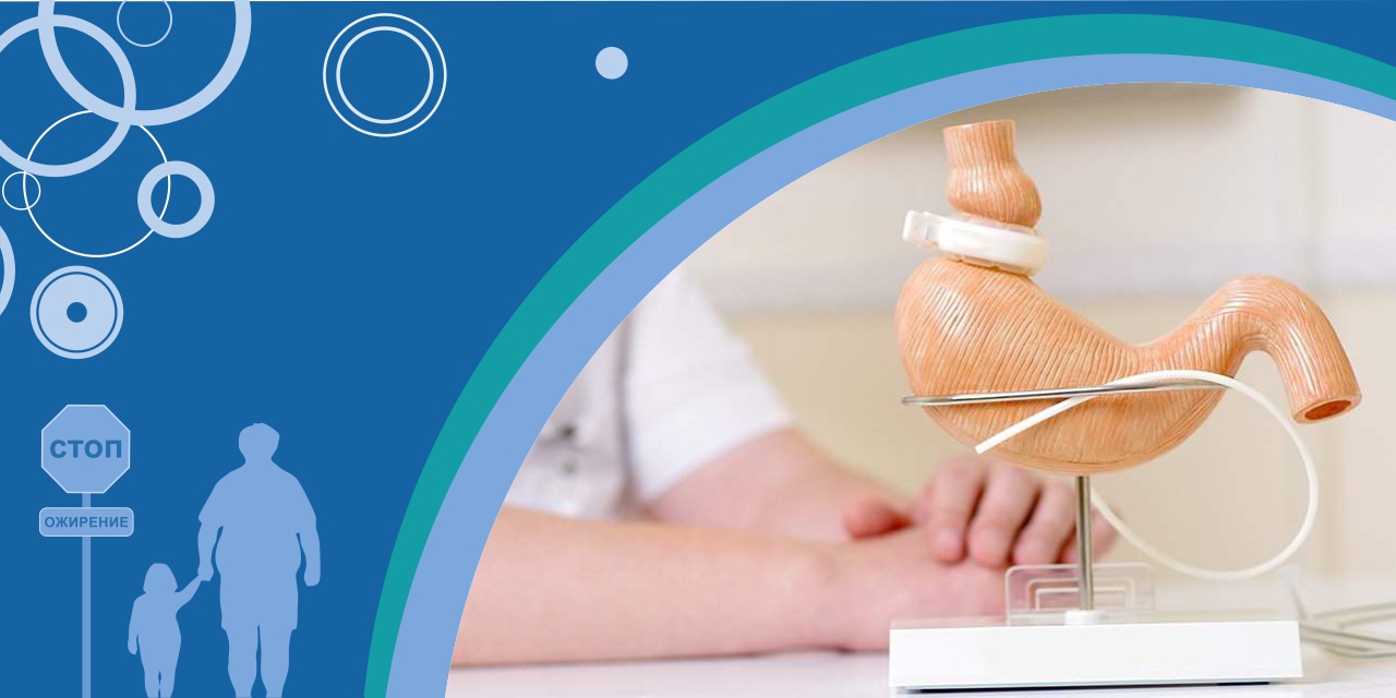 Бариатрическая хирургия: эффективный путь в борьбе с тяжёлым ожирением